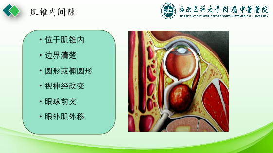 影像PPT - 【PPT】眼部常见疾病影像学定位诊断-8