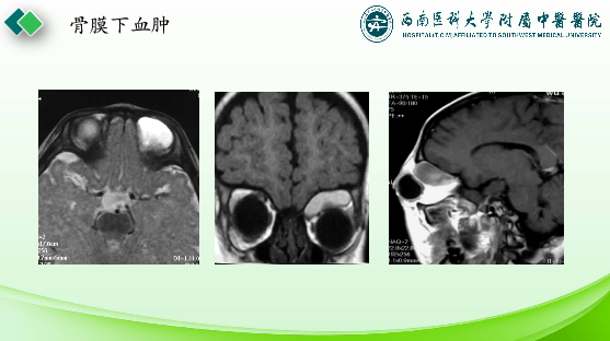 影像PPT - 【PPT】眼部常见疾病影像学定位诊断-28