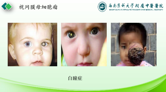 影像PPT - 【PPT】眼部常见疾病影像学定位诊断-36
