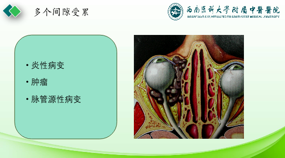 影像PPT - 【PPT】眼部常见疾病影像学定位诊断-43
