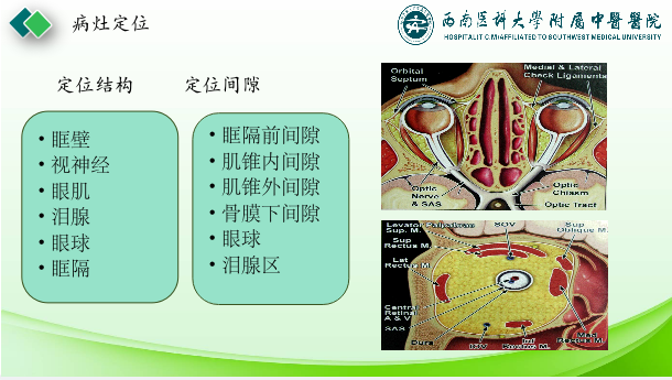 影像PPT - 【PPT】眼部常见疾病影像学定位诊断-2