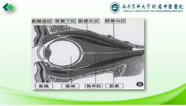 影像PPT - 【PPT】眼部常见疾病影像学定位诊断-3