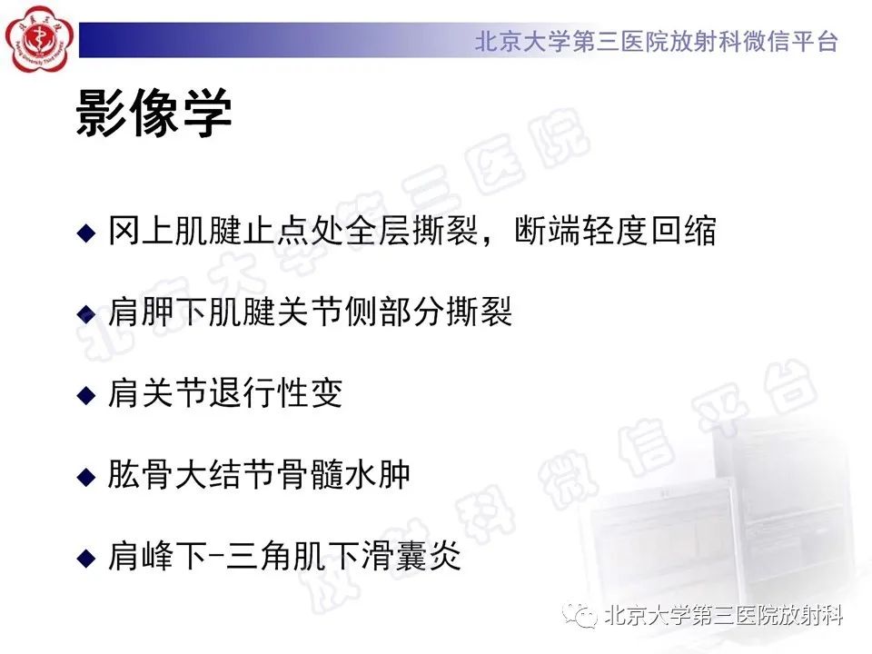 影像PPT - 【PPT】肩胛下肌腱断裂-5