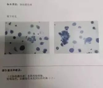 影像PPT - 【病例】肺隐球菌病1例CT影像-20 影像PPT - 【病例】肺隐球菌病1例CT影像-20