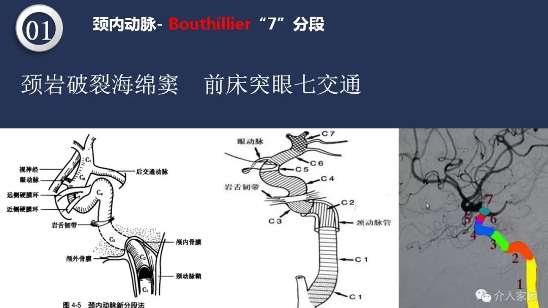 影像PPT - 【PPT】颅内动脉系统相关解剖-8
