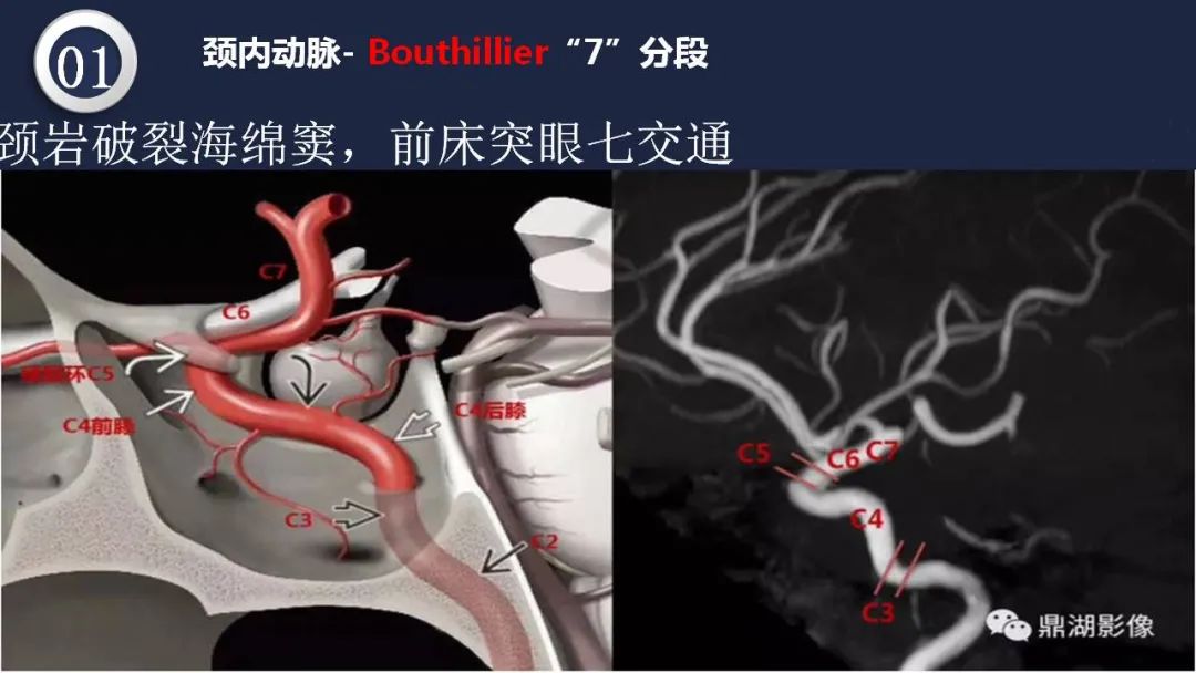 影像PPT - 【PPT】颅内动脉系统相关解剖-9