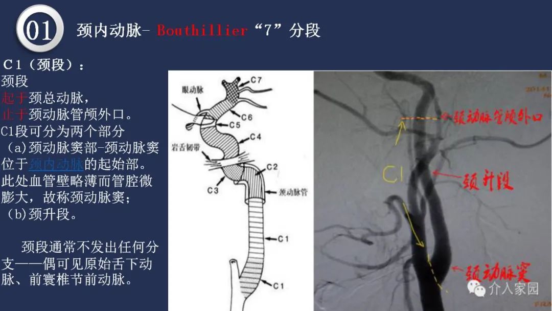 影像PPT - 【PPT】颅内动脉系统相关解剖-10