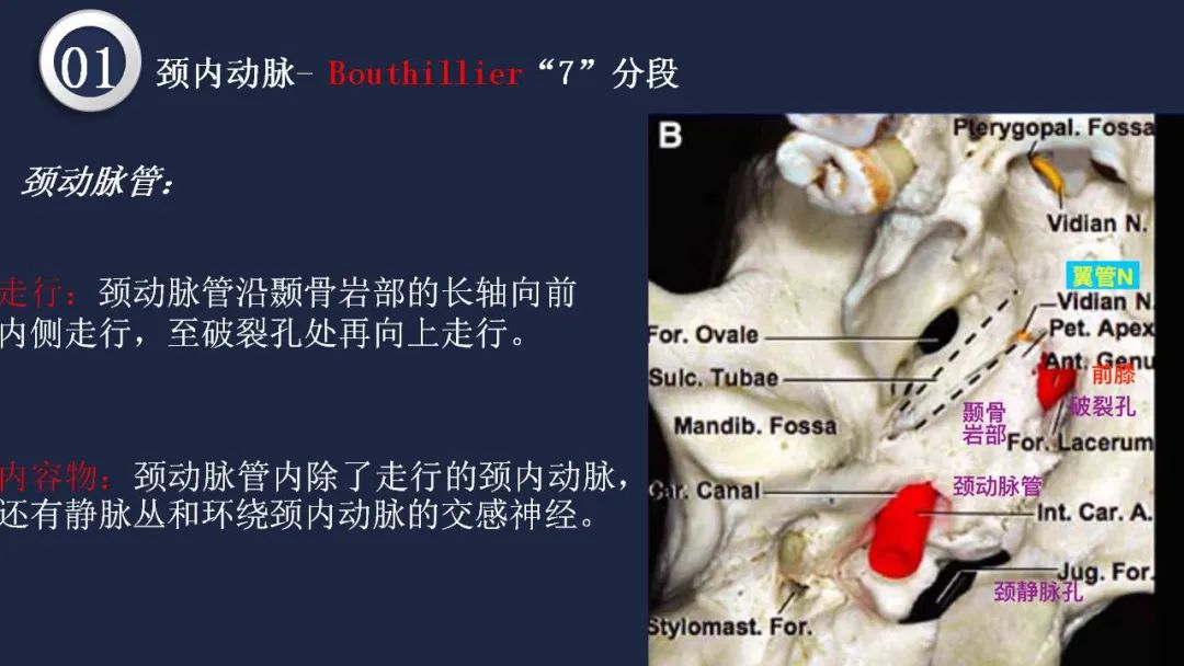 影像PPT - 【PPT】颅内动脉系统相关解剖-13