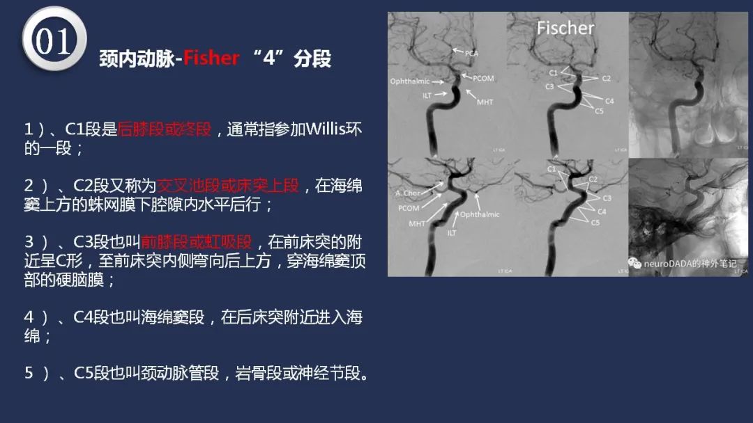 影像PPT - 【PPT】颅内动脉系统相关解剖-6