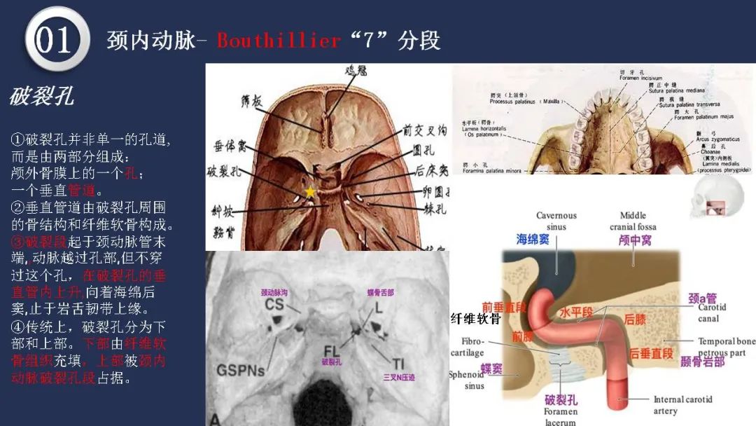 影像PPT - 【PPT】颅内动脉系统相关解剖-15