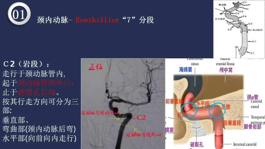 影像PPT - 【PPT】颅内动脉系统相关解剖-17