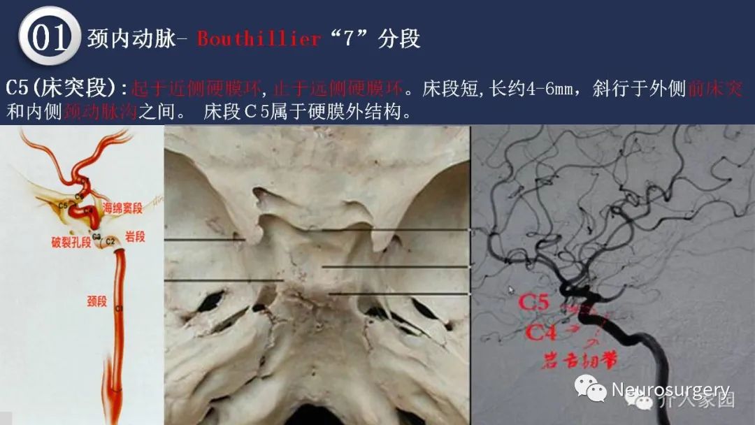 影像PPT - 【PPT】颅内动脉系统相关解剖-22