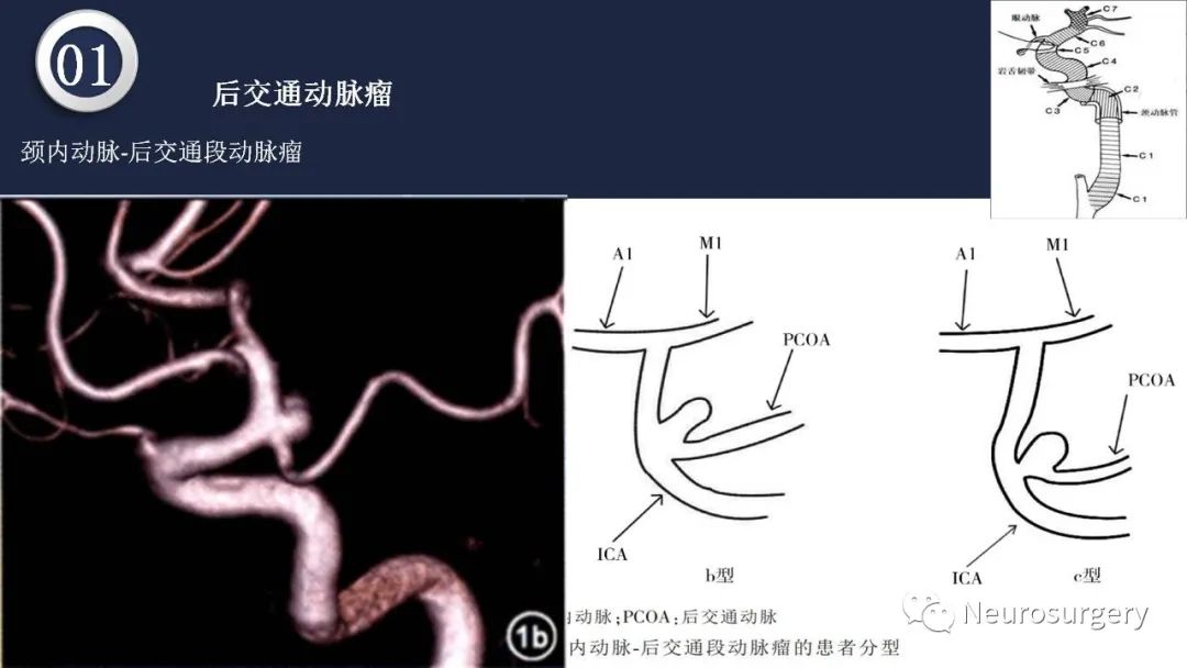 影像PPT - 【PPT】颅内动脉系统相关解剖-27