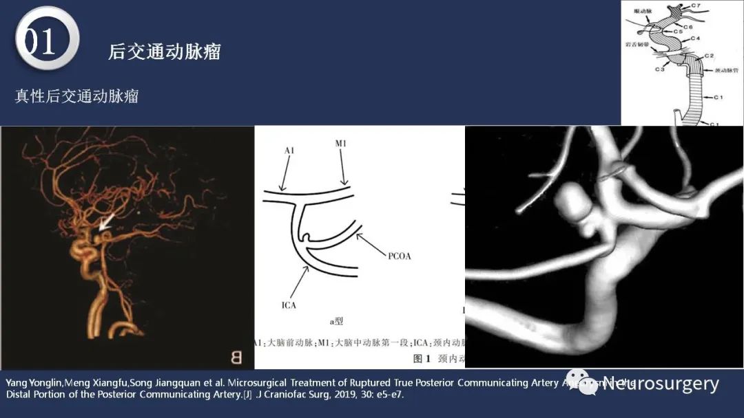 影像PPT - 【PPT】颅内动脉系统相关解剖-28