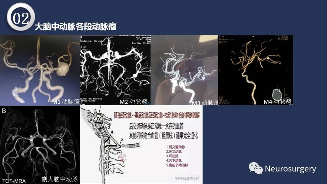 影像PPT - 【PPT】颅内动脉系统相关解剖-38