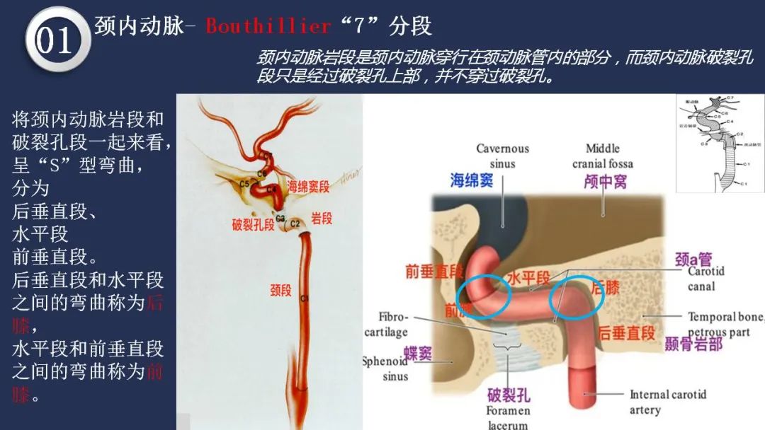 影像PPT - 【PPT】颅内动脉系统相关解剖-16