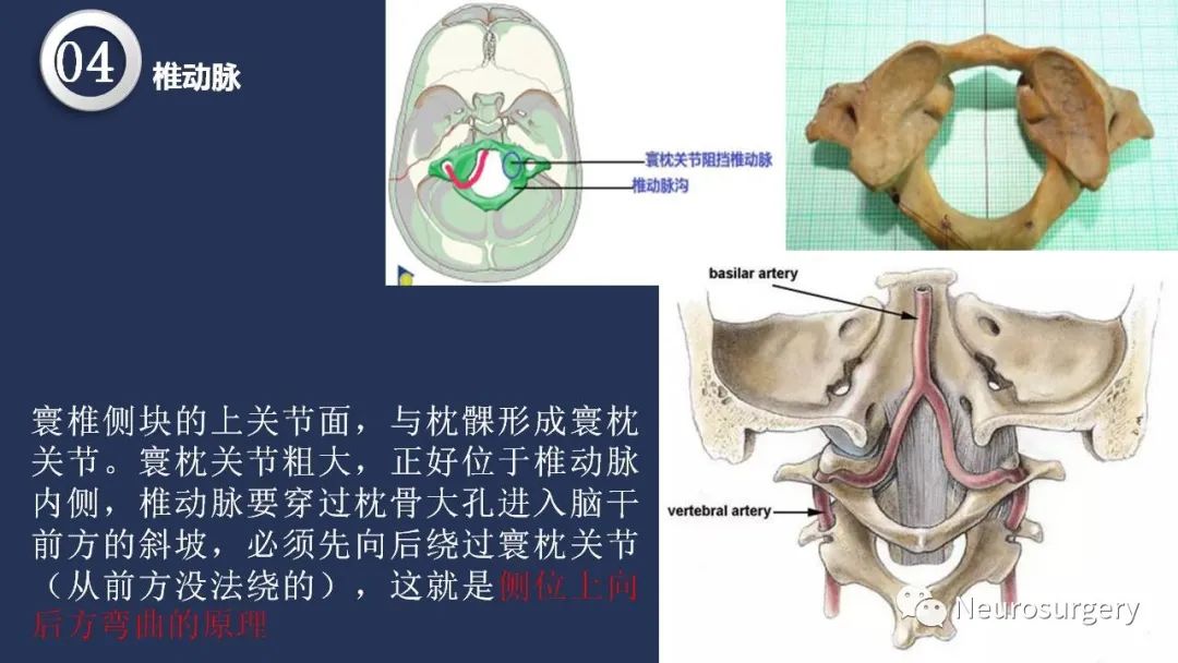 影像PPT - 【PPT】颅内动脉系统相关解剖-54