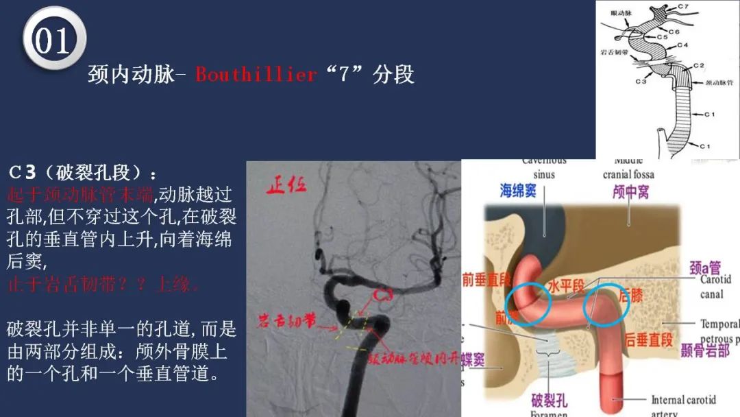 影像PPT - 【PPT】颅内动脉系统相关解剖-18
