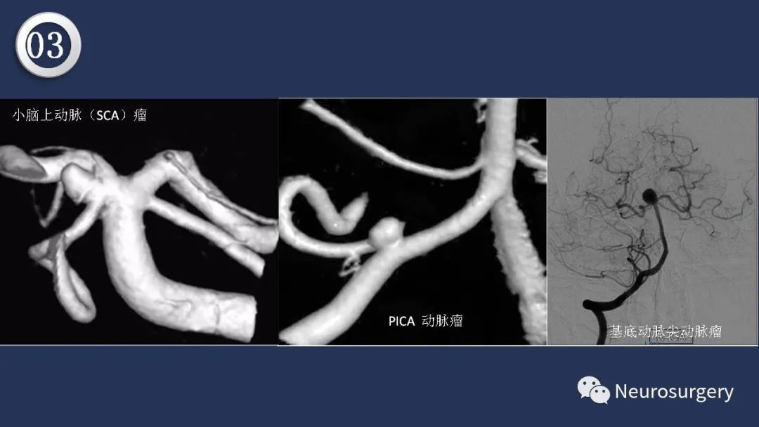 影像PPT - 【PPT】颅内动脉系统相关解剖-61