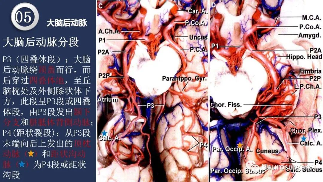 影像PPT - 【PPT】颅内动脉系统相关解剖-66
