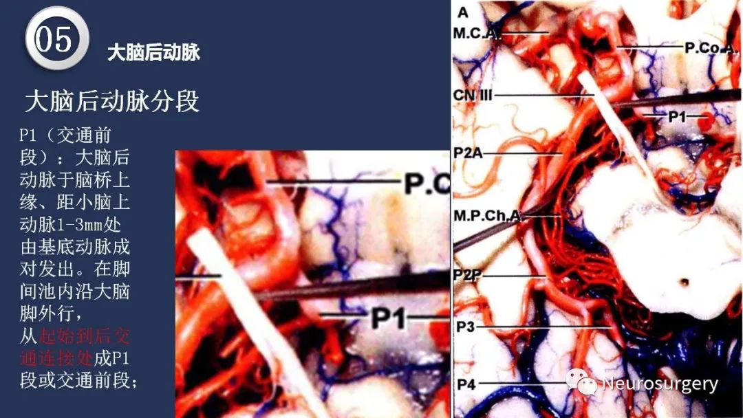 影像PPT - 【PPT】颅内动脉系统相关解剖-64