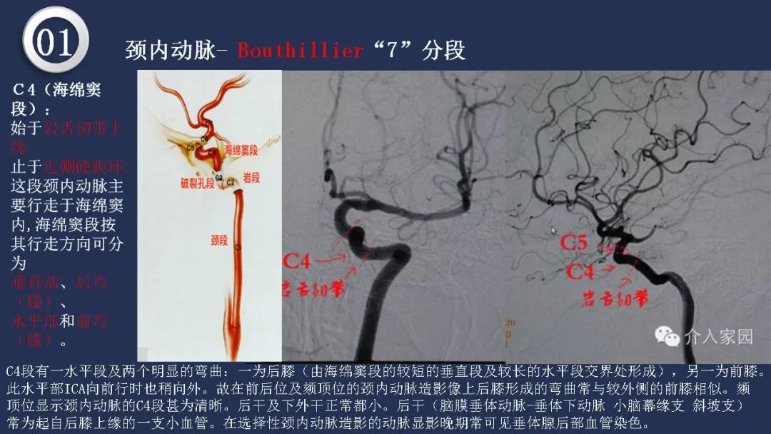 影像PPT - 【PPT】颅内动脉系统相关解剖-20