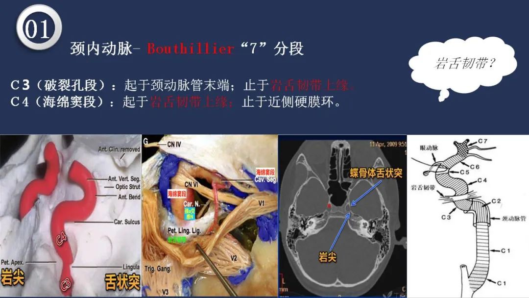 影像PPT - 【PPT】颅内动脉系统相关解剖-19