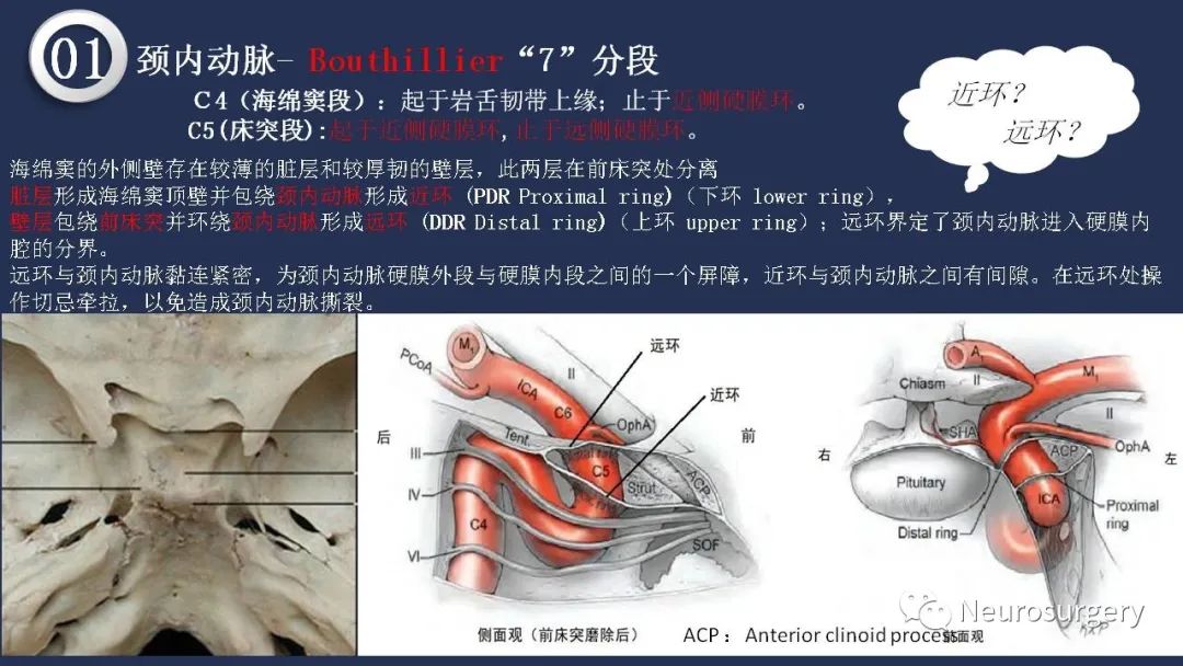 影像PPT - 【PPT】颅内动脉系统相关解剖-21