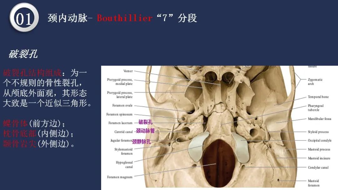 影像PPT - 【PPT】颅内动脉系统相关解剖-14