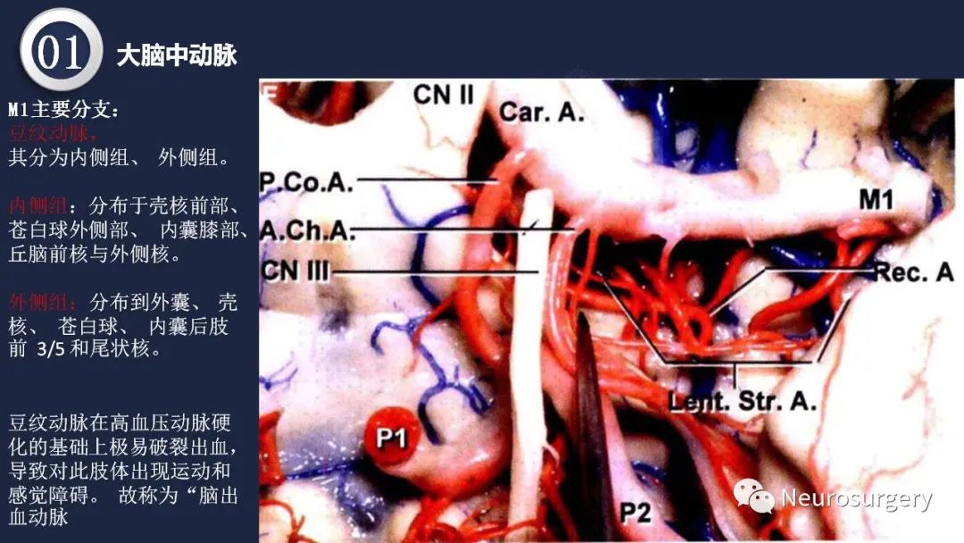 影像PPT - 【PPT】颅内动脉系统相关解剖-33