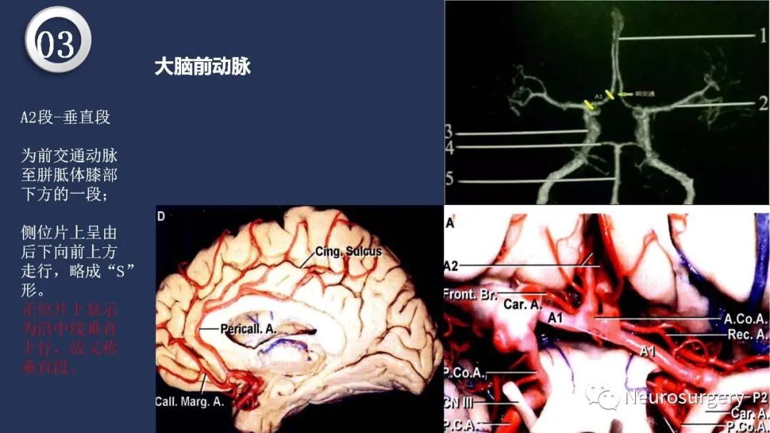 影像PPT - 【PPT】颅内动脉系统相关解剖-43