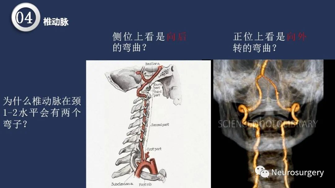 影像PPT - 【PPT】颅内动脉系统相关解剖-52
