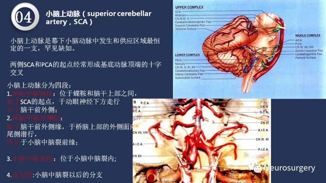 影像PPT - 【PPT】颅内动脉系统相关解剖-56
