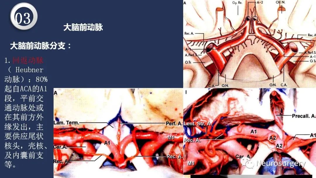 影像PPT - 【PPT】颅内动脉系统相关解剖-45