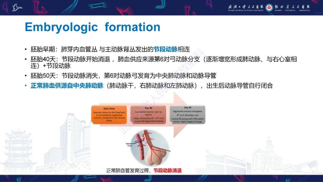 影像PPT - 【PPT】主肺动脉侧支影像诊断-6