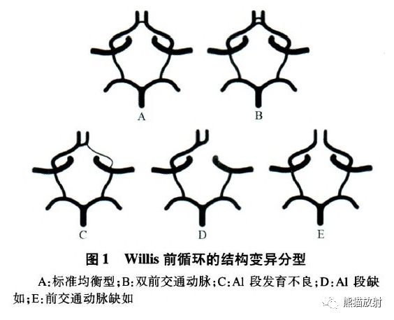 影像PPT - Willis 环的解剖、影像与变异-4 影像PPT - Willis 环的解剖、影像与变异-4