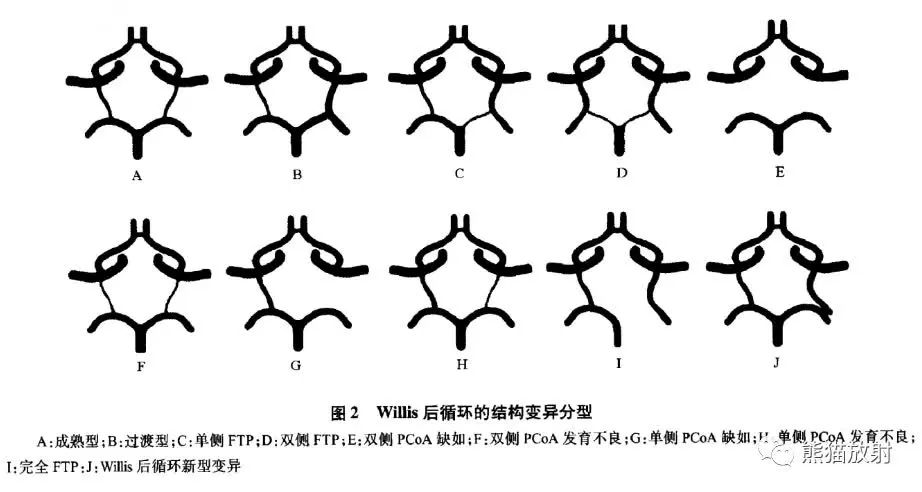 影像PPT - Willis 环的解剖、影像与变异-5 影像PPT - Willis 环的解剖、影像与变异-5