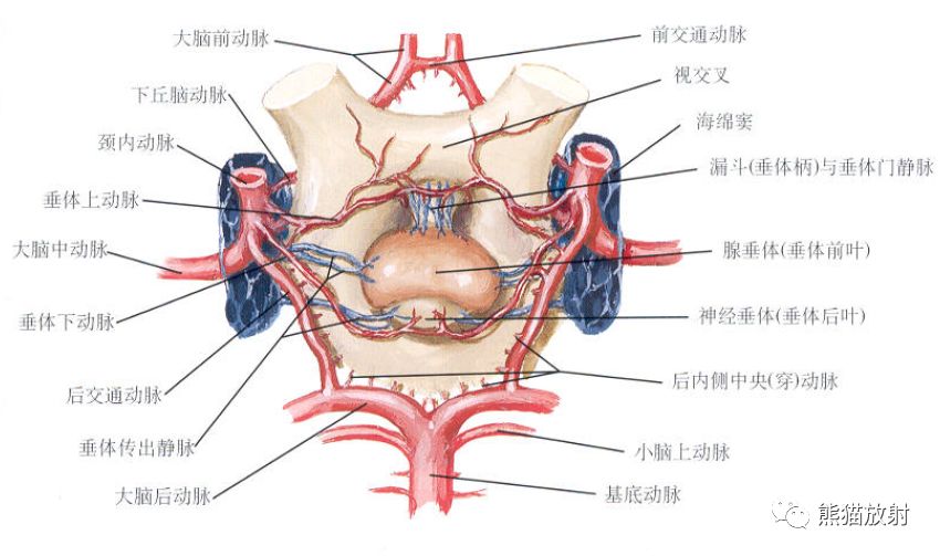 影像PPT - Willis 环的解剖、影像与变异-8 影像PPT - Willis 环的解剖、影像与变异-8