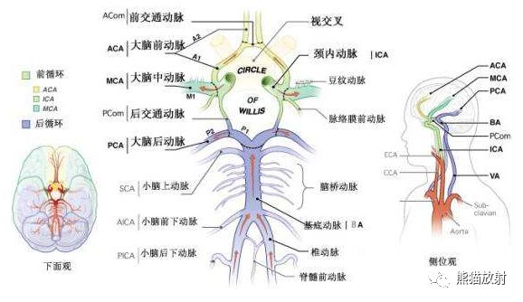 影像PPT - Willis 环的解剖、影像与变异-3 影像PPT - Willis 环的解剖、影像与变异-3
