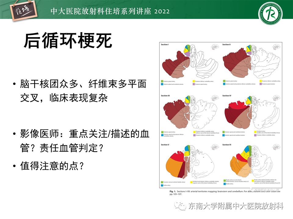 影像PPT - 【PPT】大脑后循环供血区脑梗死影像学表现-5