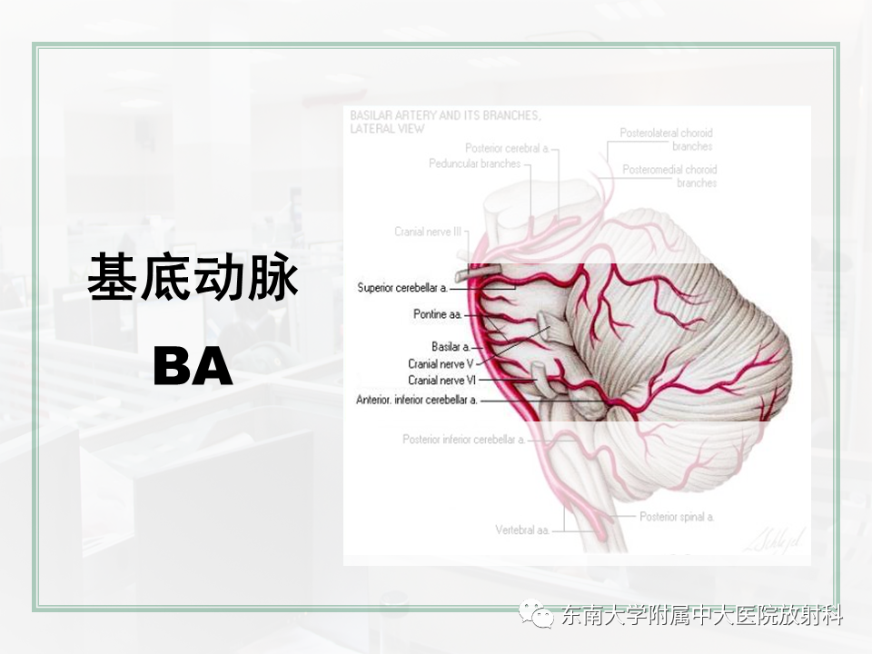 影像PPT - 【PPT】大脑后循环供血区脑梗死影像学表现-15