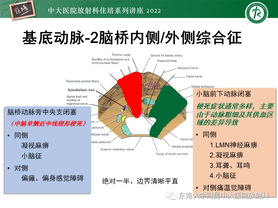 影像PPT - 【PPT】大脑后循环供血区脑梗死影像学表现-18