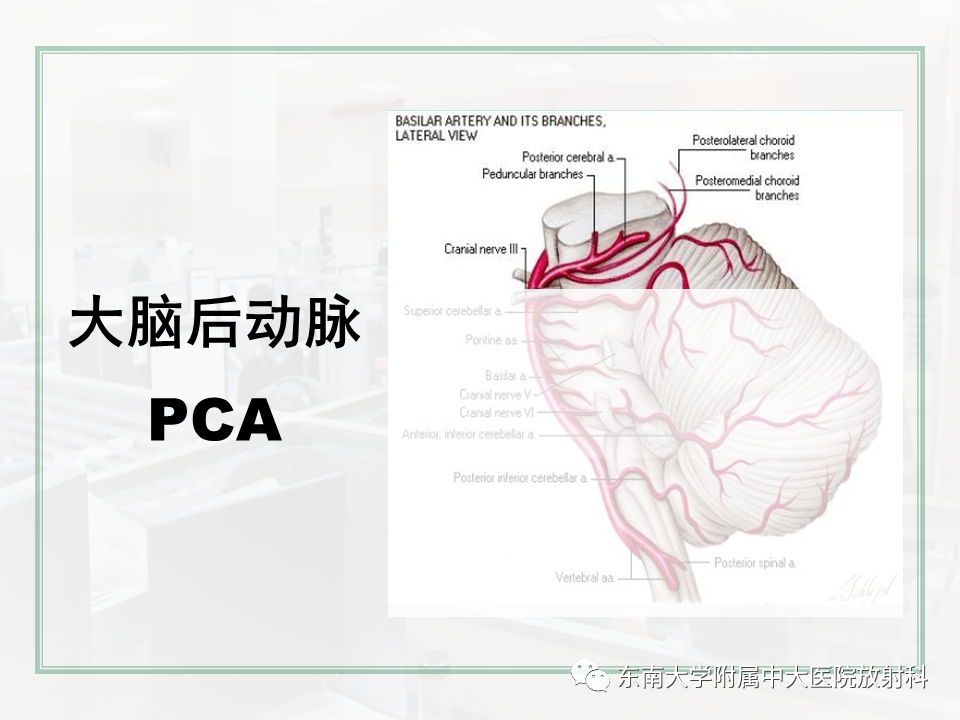 影像PPT - 【PPT】大脑后循环供血区脑梗死影像学表现-9