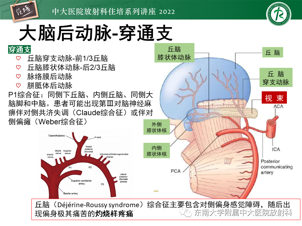 影像PPT - 【PPT】大脑后循环供血区脑梗死影像学表现-11