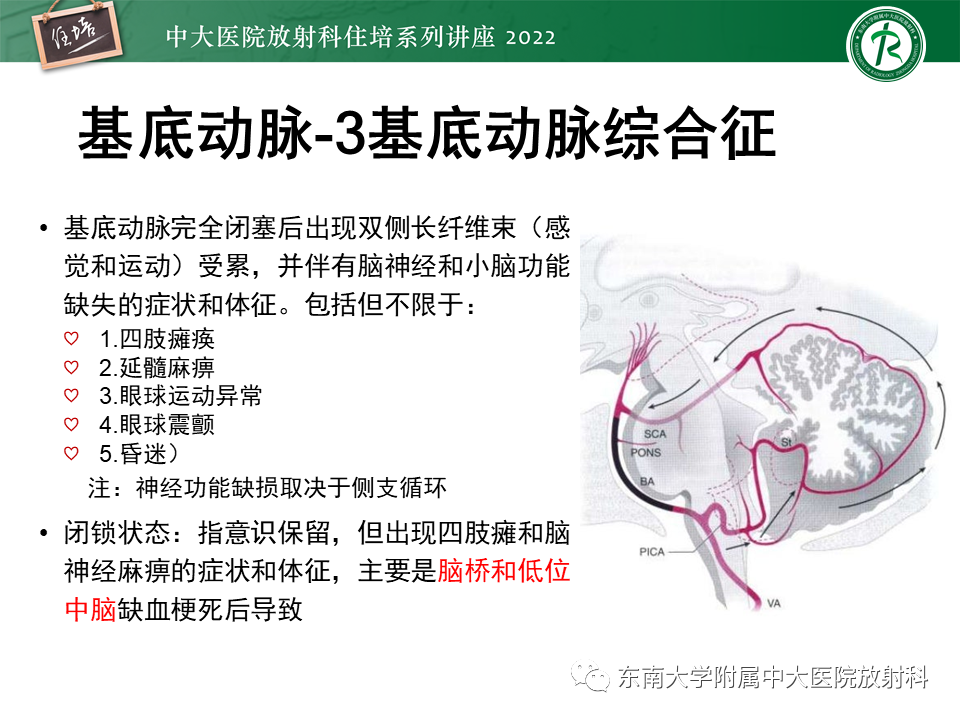 影像PPT - 【PPT】大脑后循环供血区脑梗死影像学表现-20