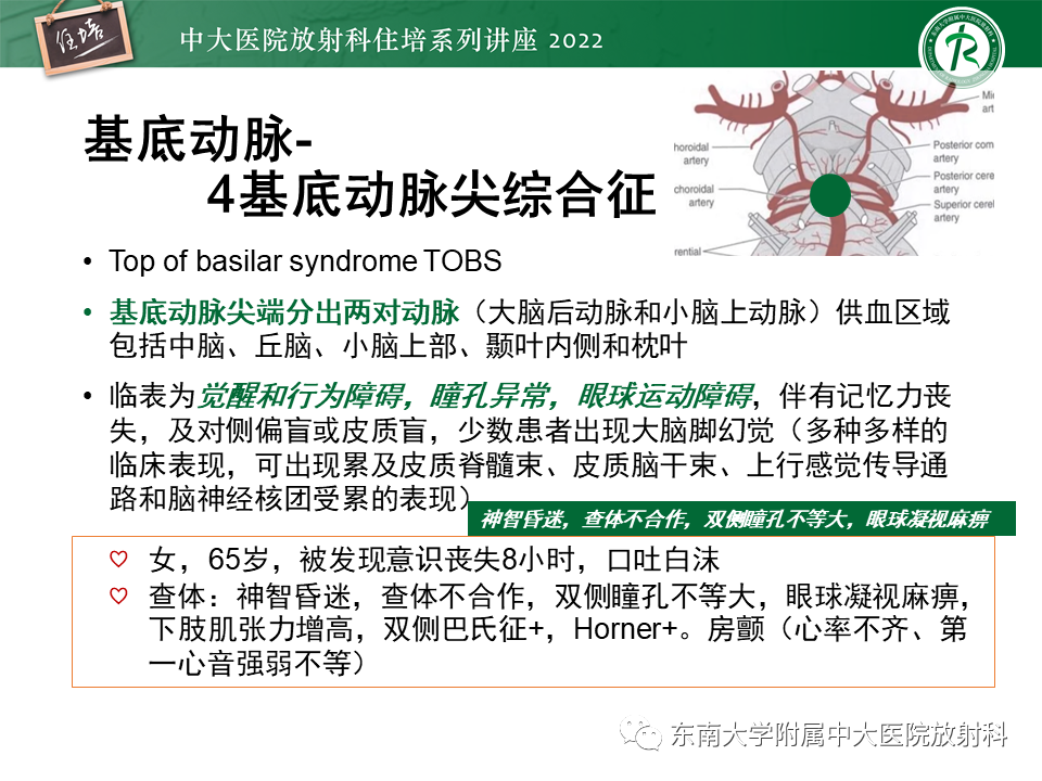 影像PPT - 【PPT】大脑后循环供血区脑梗死影像学表现-22