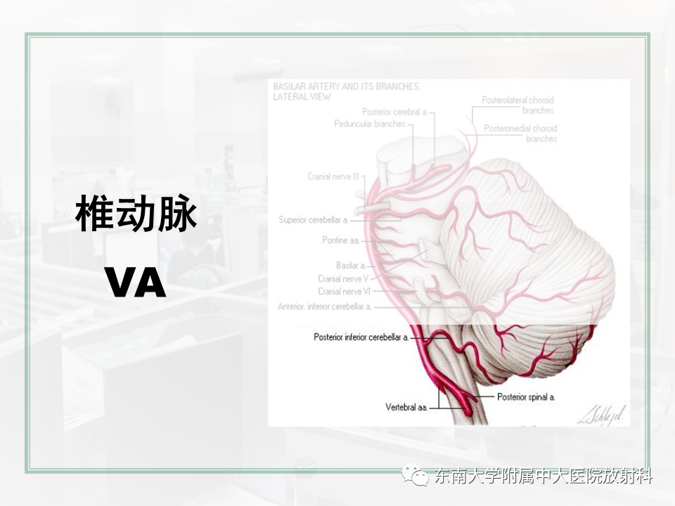 影像PPT - 【PPT】大脑后循环供血区脑梗死影像学表现-25