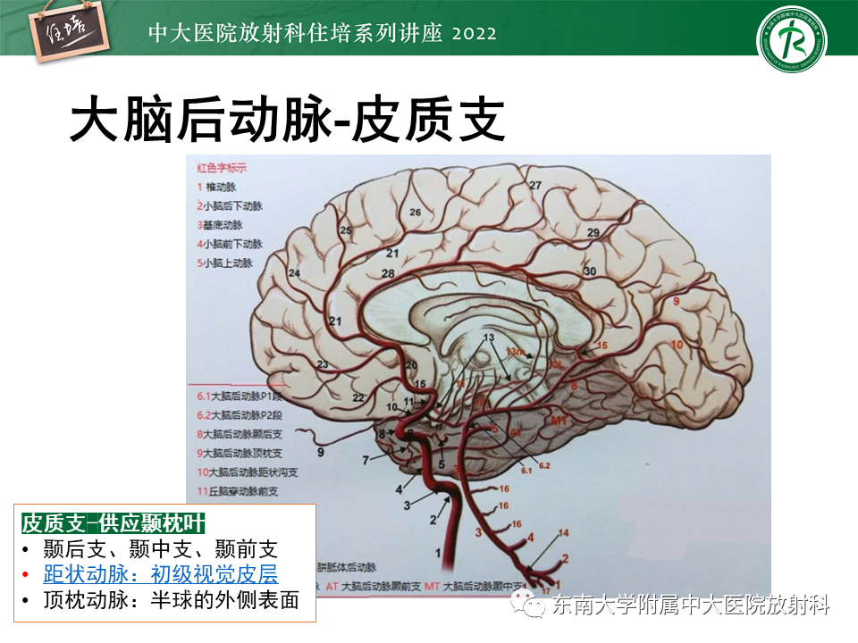 影像PPT - 【PPT】大脑后循环供血区脑梗死影像学表现-12