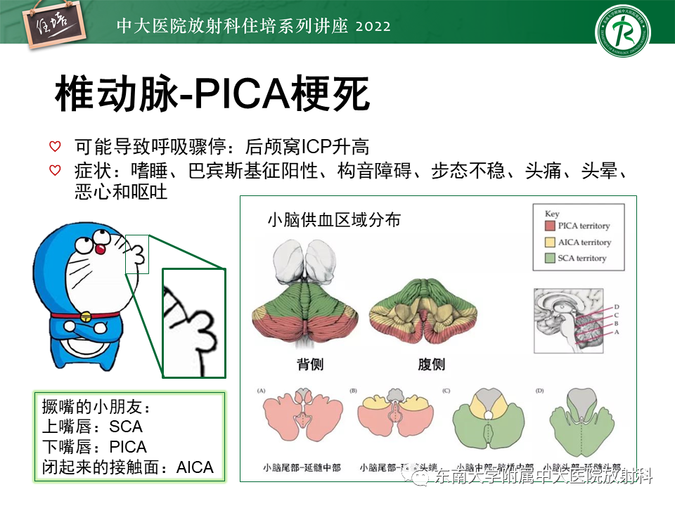影像PPT - 【PPT】大脑后循环供血区脑梗死影像学表现-27