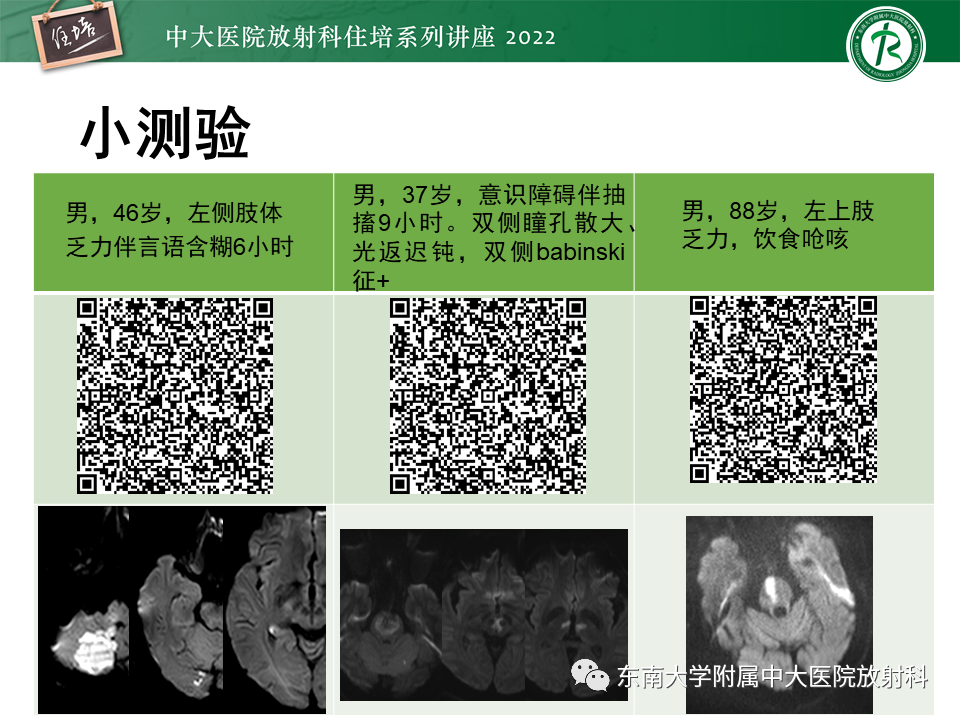 影像PPT - 【PPT】大脑后循环供血区脑梗死影像学表现-34